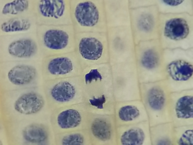 Onion Root Mitosis Slides - Onion Root  Mitosis 12 400X